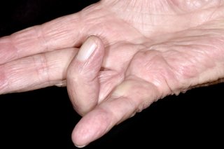 Hvid højre hånd holdt fladt ud med ringfingeren bøjet ind mod håndfladen
