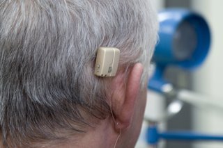Billede af benforankret høreapparat