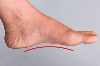 En kvindes venstre fod med et hævet område (bue) synligt langs bunden af foden