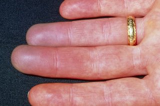 Røde fingre forårsaget af Raynauds