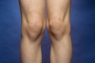 Billede af banke knæ