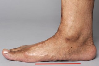 En mands højre fod placeret fladt på jorden. Der er ikke noget mellemrum mellem foden og jorden.